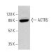 ACTR5 Antibody (E-8) - Western Blotting - Image 371660 