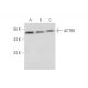 ACTR6 Antibody (G-8) - Western Blotting - Image 333669 