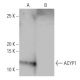 ACYP1 Antibody (2-RE16) - Western Blotting - Image 64823