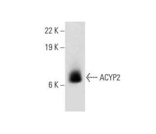 ACYP2 Antibody (B-3) - Western Blotting - Image 303889 