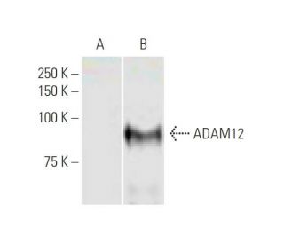 western blotting image from recommended ADAM12 (1G3) monoclonal antibody replacement. Image 347588