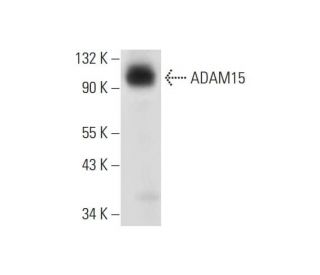ADAM15 Antibody (A-10) - Western Blotting - Image 319383