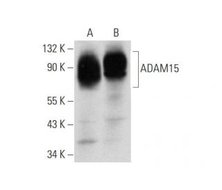 ADAM15 Antibody (D-5) - Western Blotting - Image 319384 