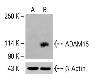 ADAM15 Antibody (D-5) - Western Blotting - Image 414353