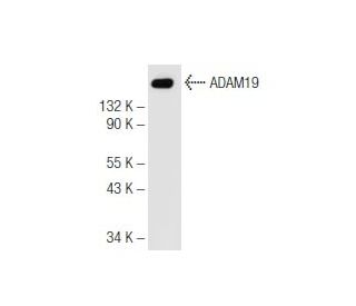 ADAM19 Antibody (14J12) - Western Blotting - Image 68176