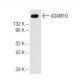 ADAM19 Antibody (14J12) - Western Blotting - Image 68176