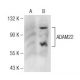 ADAM22 Antibody (C-2) - Western Blotting - Image 147260
