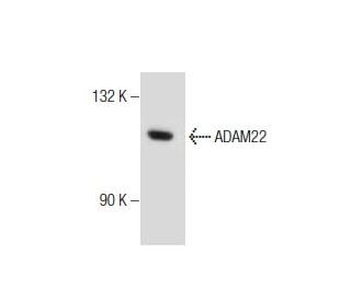 ADAM22 Antibody (C-2) - Western Blotting - Image 160620Each CRISPR/Cas9 Knockout (KO) Plasmid product consists of a pool of 3 plasmids designed to ensure identification and cleavage of a specific gene for maximum knockout efficiency. Each plasmid encodes a unique 20 nt sequence derived from the GeCKO (v2) library.