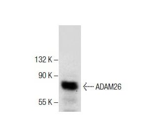 ADAM26 Antibody (G-10) - Western Blotting - Image 287620 
