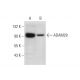 ADAM28 Antibody (H-4) - Western Blotting - Image 318069 