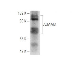 ADAM3 Antibody (F-4)
