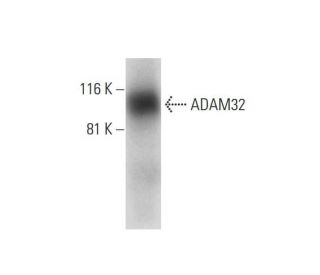ADAM32 Antibody (A-5) - Western Blotting - Image 290828 