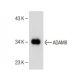 ADAM8 Antibody (F-5) - Western Blotting - Image 150428