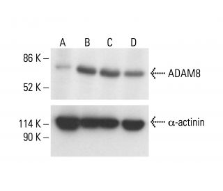 ADAM8 Antibody (F-5) - Western Blotting - Image 412164 
