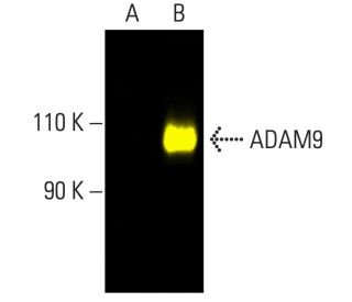 ADAM9 Antibody (G-1) - Western Blotting - Image 403287Each CRISPR/Cas9 Knockout (KO) Plasmid product consists of a pool of 3 plasmids designed to ensure identification and cleavage of a specific gene for maximum knockout efficiency. Each plasmid encodes a unique 20 nt sequence derived from the GeCKO (v2) library.