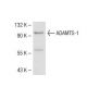 ADAMTS-1 Antibody (30D445.1) - Western Blotting - Image 41397