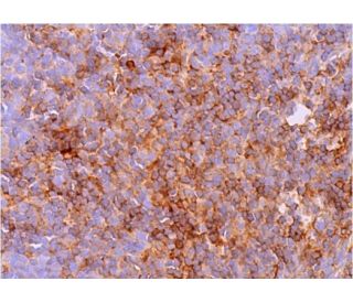 immunohistochemistry image from recommended ADAMTS-1 (3C8F4) monoclonal antibody replacement. Image 377163