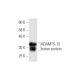 ADAMTS-15 Antibody (5F3) - Western Blotting - Image 350348