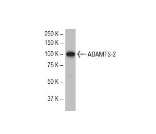 ADAMTS-2 Antibody (18Q) - Western Blotting - Image 33850 