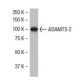 ADAMTS-2 Antibody (18Q) - Western Blotting - Image 33850 