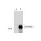 ADAMTS-2 Antibody (F-4) - Western Blotting - Image 297625