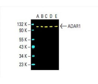ADAR1 Antibody (15.8.6) - Western Blotting - Image 393708 