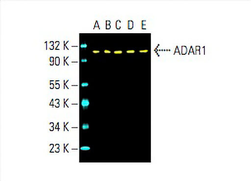 ADAR1 Antibody (15.8.6) | SCBT - Santa Cruz Biotechnology
