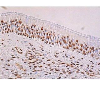 ADAR1 Antibody (D-8) | SCBT - Santa Cruz Biotechnology