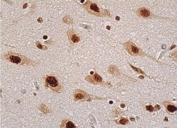 ADAR1 Antibody (D-8) | SCBT - Santa Cruz Biotechnology