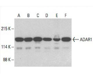 ADAR1 Antibody (D-8) | SCBT - Santa Cruz Biotechnology