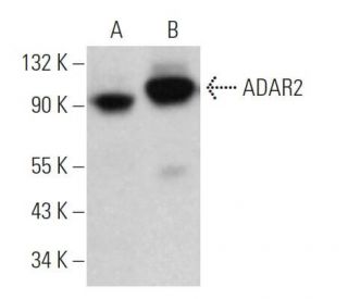 ADAR2 Antibody (1.3.1) - Western Blotting - Image 374720 