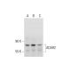 western blotting image from recommended ADAR2 (C-6) monoclonal antibody replacement. Image 325252