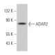 ADAR2 Antibody (F-9) - Western Blotting - Image 361875