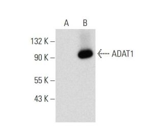ADAT1 Antibody (C-5) - Western Blotting - Image 137007