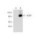 ADAT1 Antibody (C-5) - Western Blotting - Image 137007