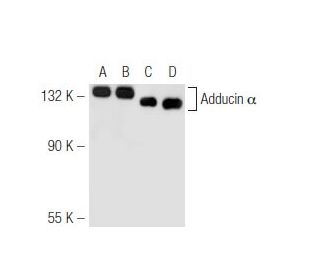 Adducin &alpha; Antibody (4D1) - Western Blotting - Image 45683 