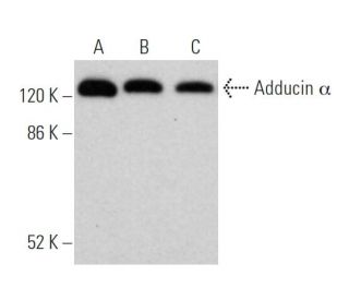 Adducin &alpha; Antibody (4D1) - Western Blotting - Image 373468 