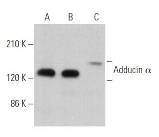 Adducin &alpha; Antibody (A-5) - Western Blotting - Image 362814Each CRISPR/Cas9 Knockout (KO) Plasmid product consists of a pool of 3 plasmids designed to ensure identification and cleavage of a specific gene for maximum knockout efficiency. Each plasmid encodes a unique 20 nt sequence derived from the GeCKO (v2) library. 
