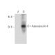 Adenosine A1-R Antibody (D-5) - Western Blotting - Image 319912