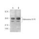 Adenosine A1-R Antibody (HA1) - Western Blotting - Image 372367