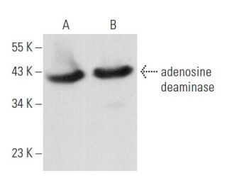adenosine deaminase Antibody (D-10) - Western Blotting - Image 357176 