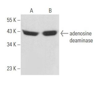 western blotting image from recommended adenosine deaminase (D-4) monoclonal antibody replacement. Image 357179