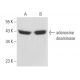 western blotting image from recommended adenosine deaminase (D-4) monoclonal antibody replacement. Image 357179