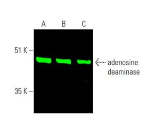 adenosine deaminase Antibody (D-4) - Western Blotting - Image 385852