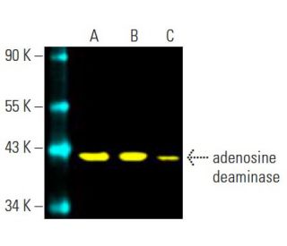 adenosine deaminase Antibody (D-4) - Western Blotting - Image 396449