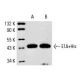 western blotting image from recommended Adenovirus-2/5 E1A (M73) monoclonal antibody replacement. Image 4502