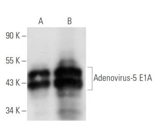 Adenovirus-5 E1A Antibody (M58) - Western Blotting - Image 14724