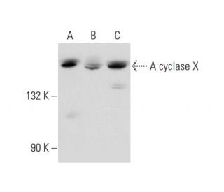 Adenylate cyclase 10/ADCY10 Antibody (B-1) - Western Blotting - Image 344118SAM Transcription Activation: SAM system utilizing dCas9-VP64, MS2-P65-HSF1, and sgRNA for precise gene transcription activation.