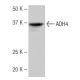 ADH4 Antibody (NB-B2) - Western Blotting - Image 64827 