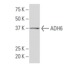 ADH6 Antibody (WW32) - Western Blotting - Image 33866